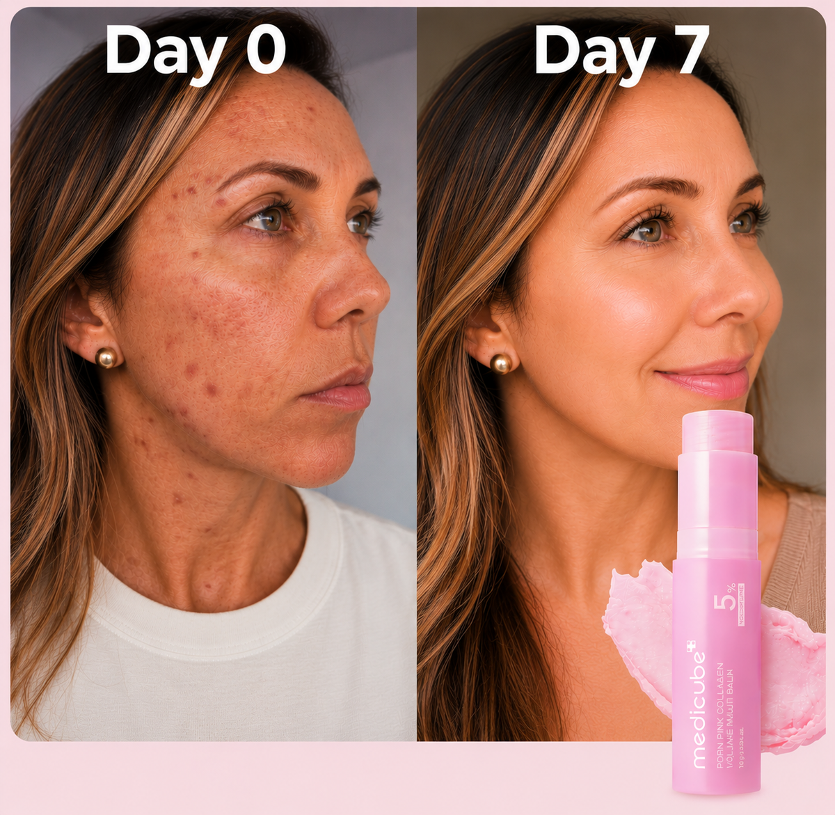 PDRN Pink Collagen Volume Multi Balm by medicube